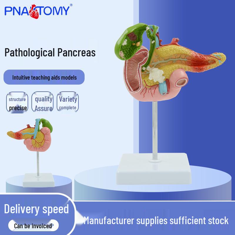 Pathological Pancreas Specimen & Anatomy Model: Pancreas, Spleen, Liver, Gallbladder, Duodenum Simulation 25x11x15 cm