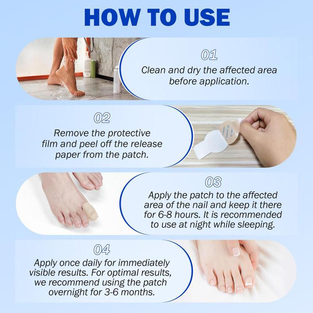 Fungal-Nail Patch Non-Irritation Strengthens Moisturizes Anti Toenail-Fungus Treat Sticker Quick Absorption Rehabilitation Patch