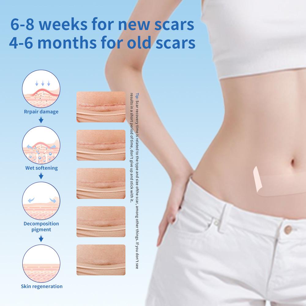 Invisible Scar Patch Transparent Scar Patch Scar Removal and Repair Patch  (40mm X 1.5m)