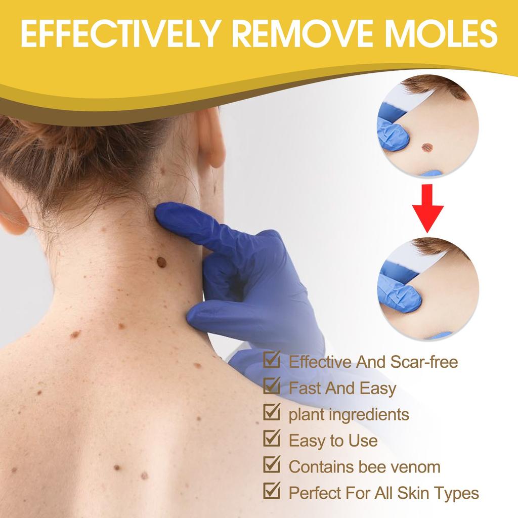 Bee Relief Ointment, Bee  Gel, And Bee  Can Remove Skin Pimples Without Irritation Or Traces,20ML