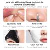 Facial Blackhead Removal Kit Facial Cleansing Remove Pimples and Blemishes Gentle Pore Clean Exfoliating Acne Removal