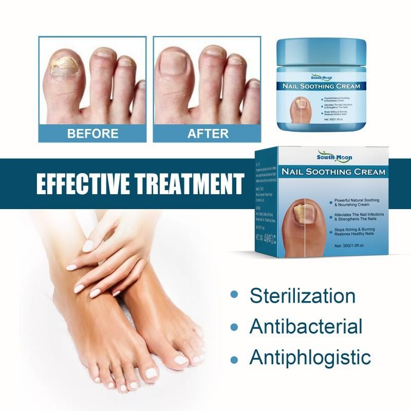 South Moon Nourishing Nail Repair Cream For Healthy Strong Nails With Moisturizing Formula