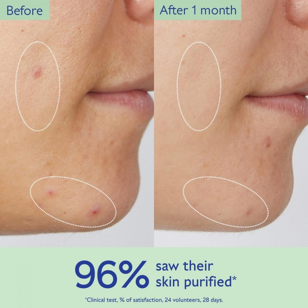 Caudalie Vinopure Pore Purifying Gel Cleanser 5 Oz