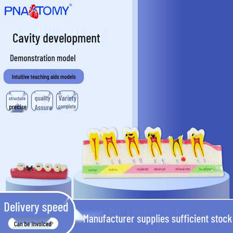 PNT-OR10 Dental Teaching Model: Caries and Periodontitis Evolution Resin