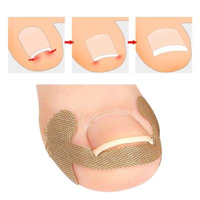 Autocollant Pouce Ongle Incarné Bande Soin Soin Protection