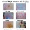 HD Digital Skin Analyzer Professional Hair Scalp Camera Detector Hair Follicle Oil Moisture Test Device 15inch