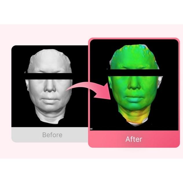 MEDICUBE PDRN Pink Lift-Up Mask Set (4 sheets + V-line up band)