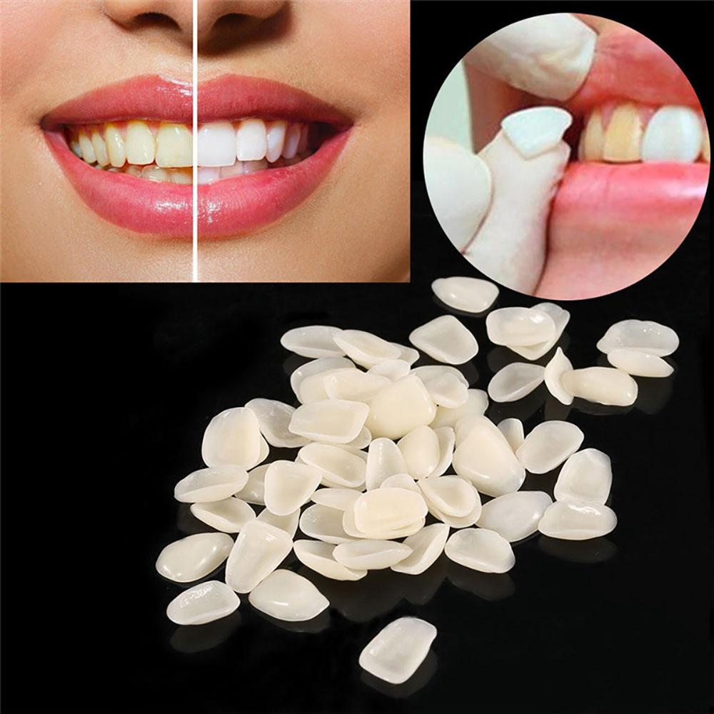 1 Bag/100Pcs Dental Temporary Crown Veneers for Anterior Front Teeth Whitening