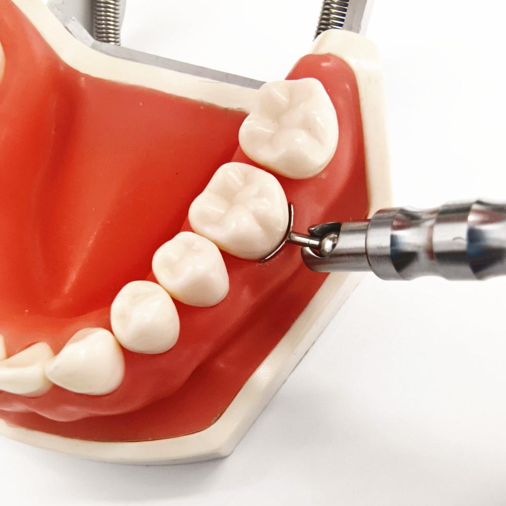 1 ensemble d'implants dentaires réglables, rétraction gingivale, rétracteur de douille gingivale, bouclier protecteur, embouts de remplacement, séparateur de gencives