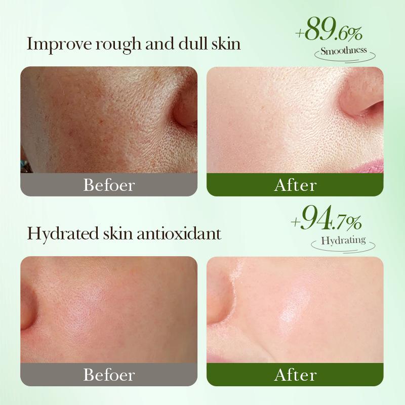 Aloe Essence Gesichtsmaske Nährende und feuchtigkeitsspendende und verjüngende Pflanzengesichtsmaske Sommer