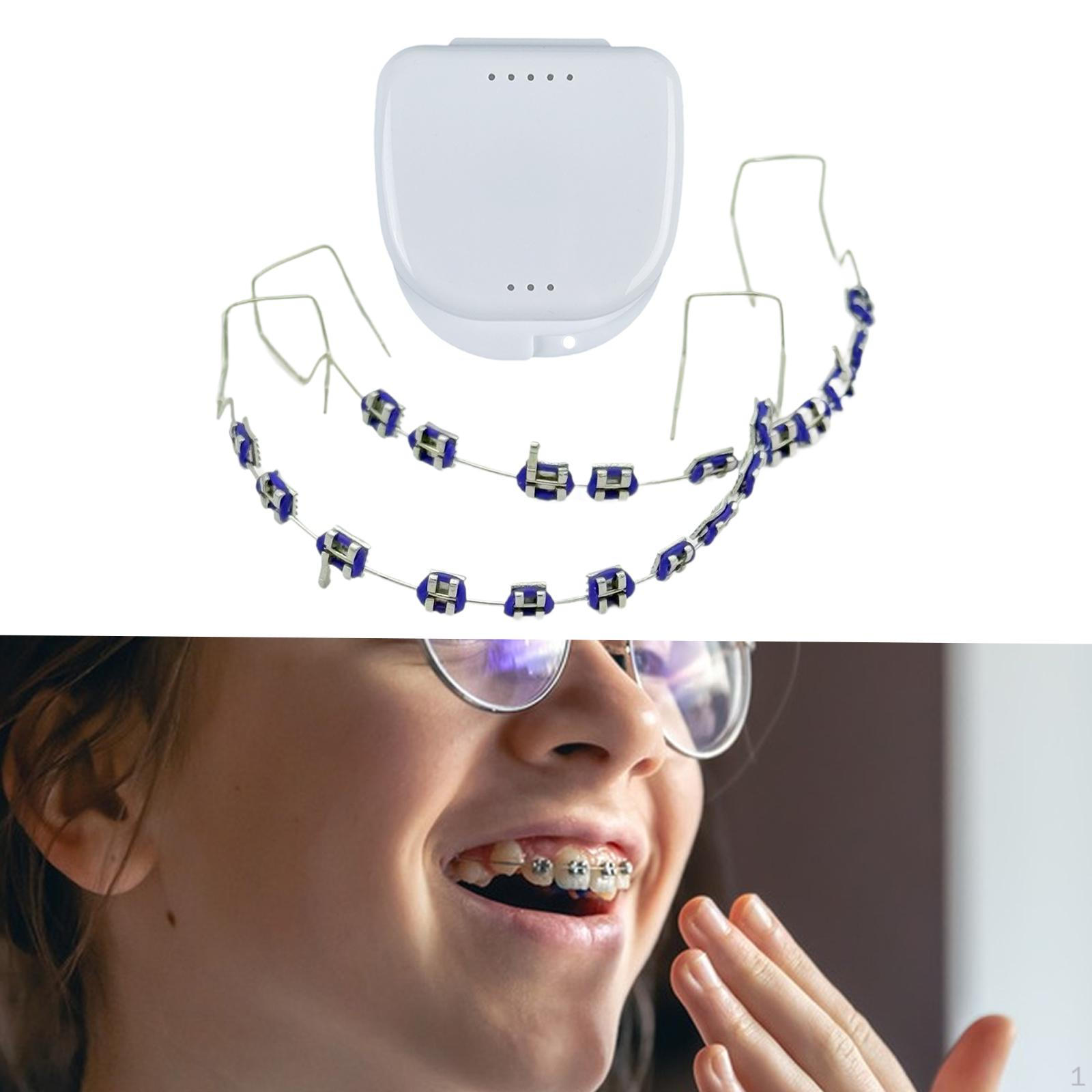 

Временные украшения для зубов с металлическим кронштейном в виде крючка в подарок семье violet