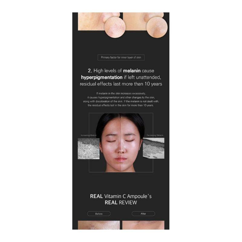 Mizon Real Vitamin C Ampoule Mini