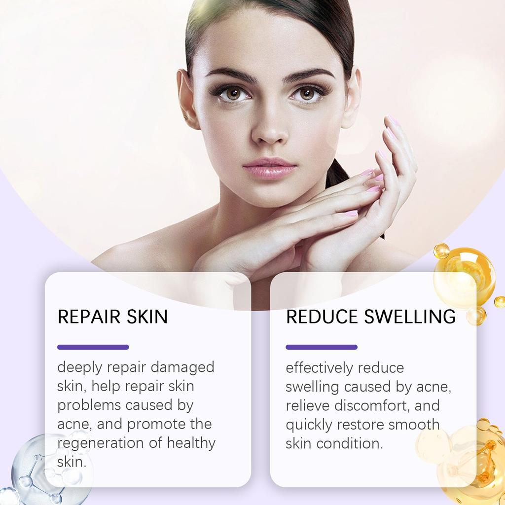 Salicylic Anti-acne Cream Repairs Facial Redness, Enlarged Pores, Acne-prone Skin, Anti-acne Cream