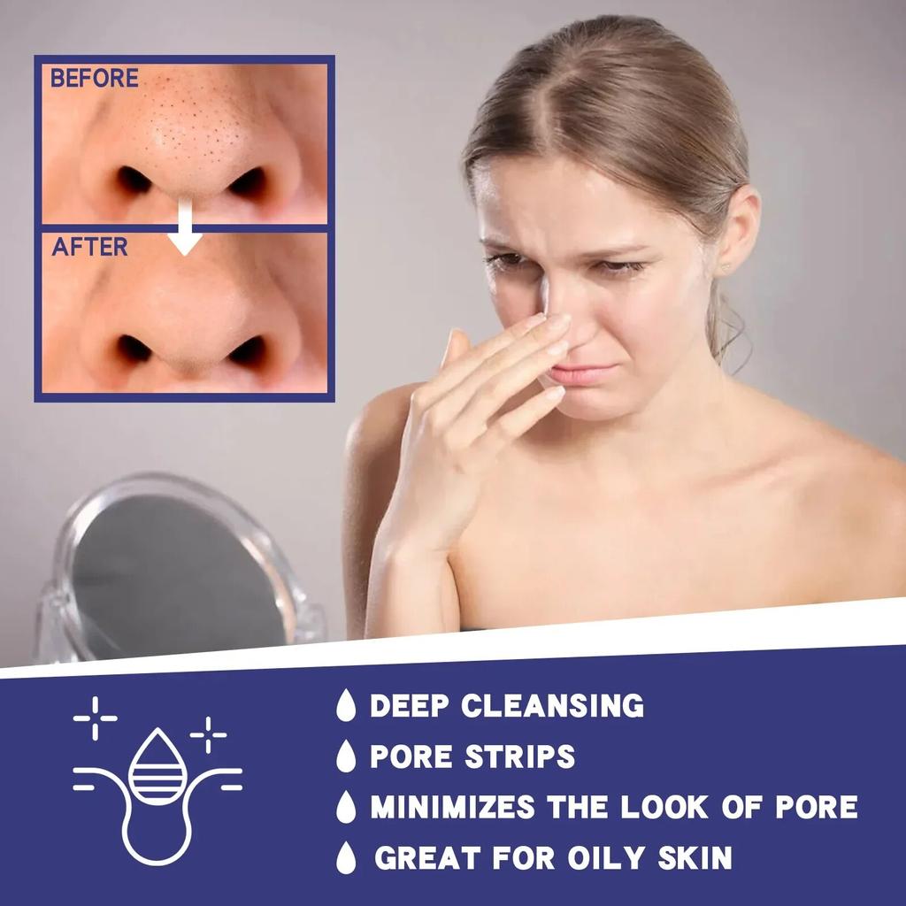 Cerotti per la rimozione dei punti neri, pulizia profonda, trattamento per acne e brufoli, punti neri, restringimento dei pori, rassodanti, leviganti, strisce per i pori del naso, 6 pezzi
