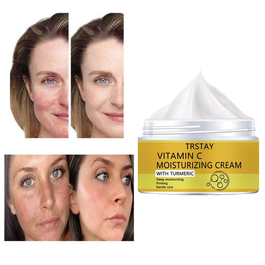 Blemish Lightening and Translucent Cream, Gentle Hydration Without Irritation, Reduces Fine Lines, Moisturizes the Skin, and Improves Damaged Skin