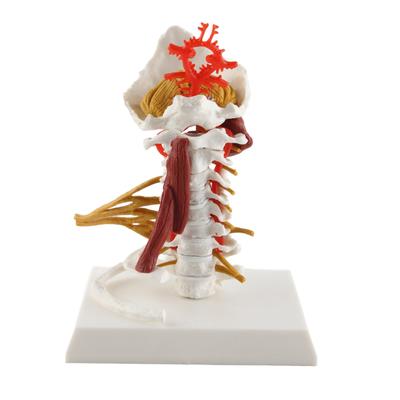 Halswirbelsäulenmodell Abnehmbares Menschliches Spinalnervenmodell für Arzt-Patienten-Kommunikation Lehre