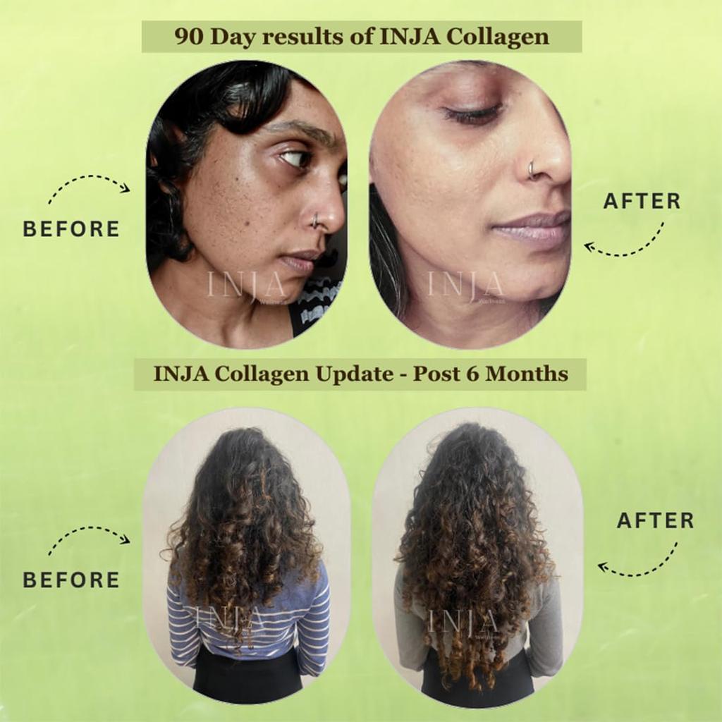 INJA Wellness Veg Collagen Supplement Powder 100% Vegetarian, No Added Sugar, Improves Skin and Hair Health, Green Apple Flavour, 150g