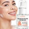 Peeling Serum-Deep Moisturizing The Facial Skin-Gently Refines Pores Skin Texture-Conctols Excess Sebum-50ml