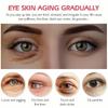 Nejnovější anti-aging zpevňující oční krém pro odstranění tmavých kruhů pod očima Tukový granulát proti vráskám zpevňující redukuje vzhled vrásek a jemných linek.