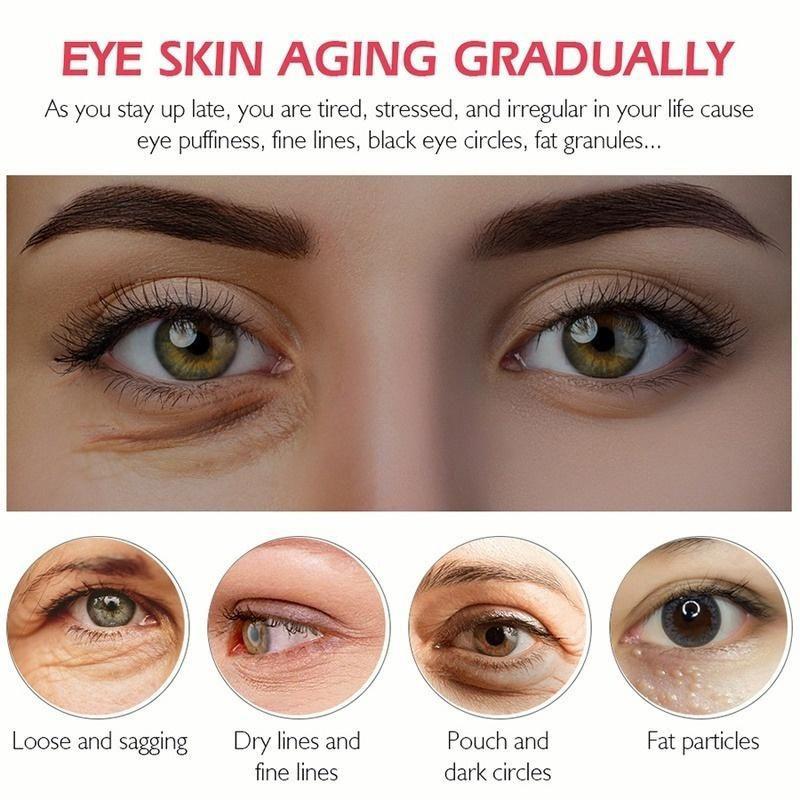 Nejnovější anti-aging zpevňující oční krém pro odstranění tmavých kruhů pod očima Tukový granulát proti vráskám zpevňující redukuje vzhled vrásek a jemných linek.