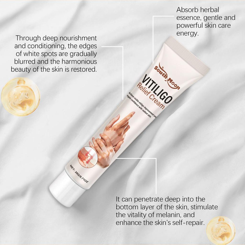 South Moon Skin Care Cream Relieves Itchy Hands And Feet Moisturizing Body Lotion