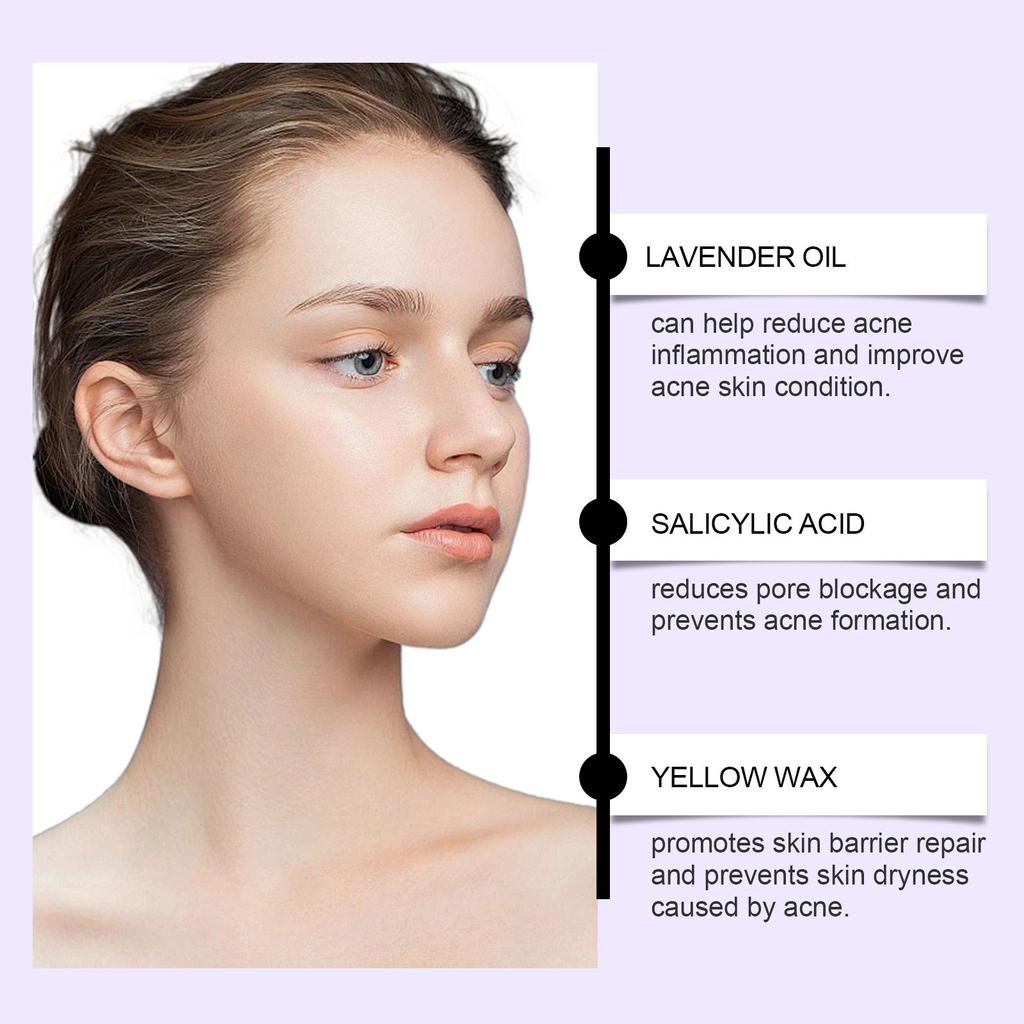 Salicylic Anti-acne Cream Repairs Facial Redness, Enlarged Pores, Acne-prone Skin, Anti-acne Cream