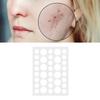 36pcs Pimple Sticker Portable Adhesive Easy Removal Imperfection Spot Cover Blemish Stickers