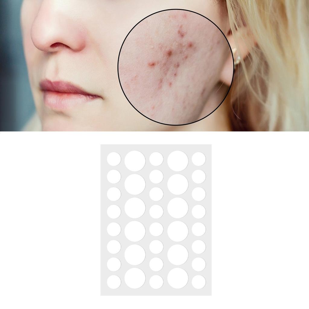 36pcs Pimple Sticker Portable Adhesive Easy Removal Imperfection Spot Cover Blemish Stickers