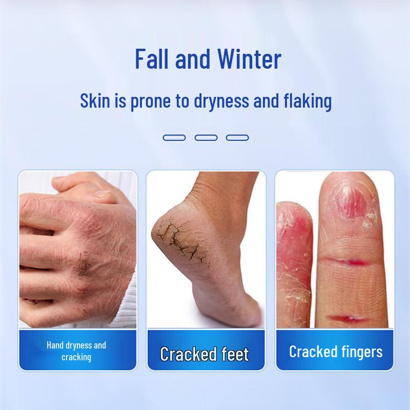 MEN WOO Hand & Foot Crack Repair Patches