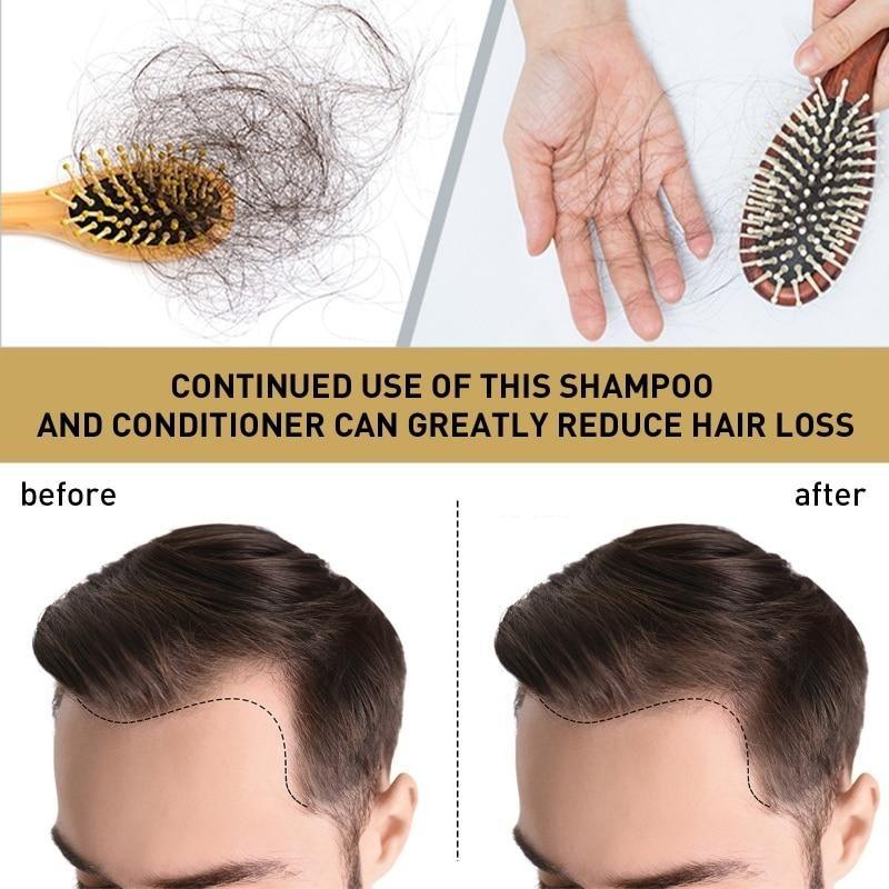 Shampoo allo zenzero Trattamento naturale del cuoio capelluto dei capelli a base di erbe non allergico Controllo dell'olio Crescita dei capelli Shampoo denso anti-perdita di capelli