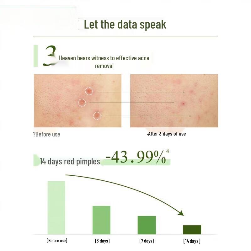 POND'S Acne Clear Purifying Facial Cleanser