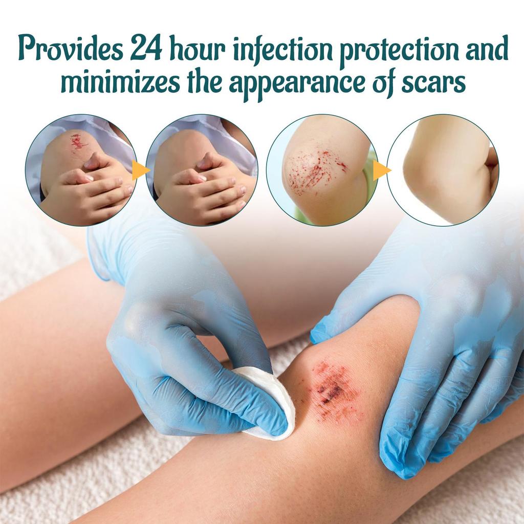 Scar Fade Ointment Scratches Recovery Relieves Skin Abrasions Wounds Fade Scars Moisturizing Skin Repair Care Cream