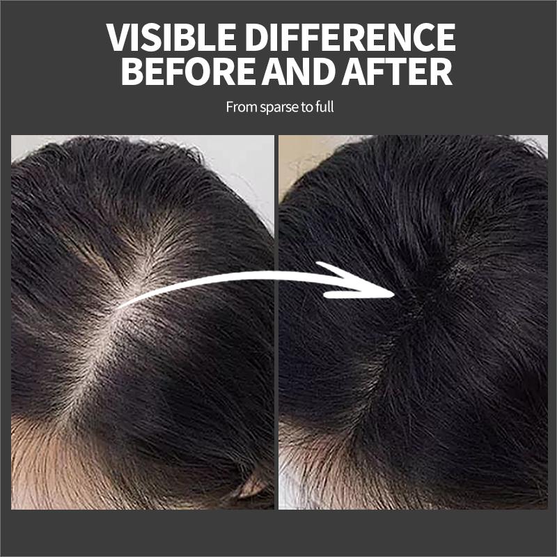 Hair Fibers Regrowth Powders Hair Building Fiber Blender Conceal Styling Fiber Professional Hair Treatment Unisex Hair Loss Products
