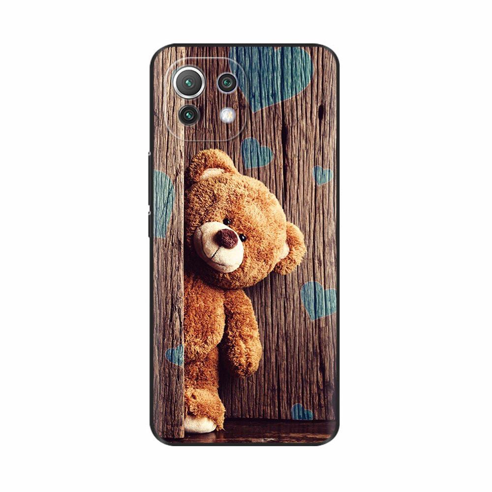 For Xiaomi Mi 11 Lite 5G NE Case Painted Soft Silicon Phone Back Cover For Xiomi Mi 11 Lite Case Mi 11 Lite Mi11 11i Shell Cover