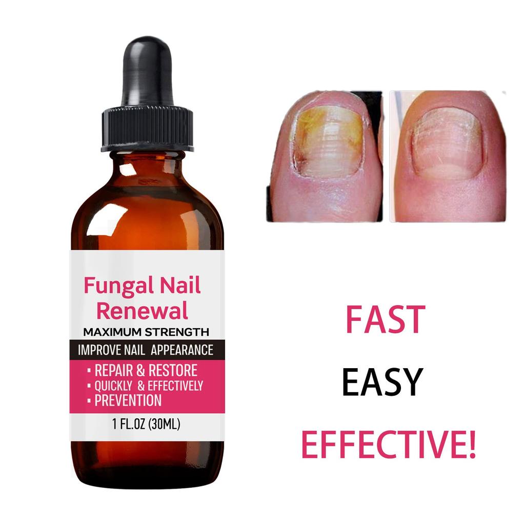 Liquid For Manicure Protects Hands And Toenails\30ml