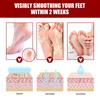 Jaysuing Fruit Acid Exfoliating Foot Mask Gently Exfoliates, Softens Calluses, Rejuvenates Skin, Moisturizes and Moisturizes Beautiful Feet
