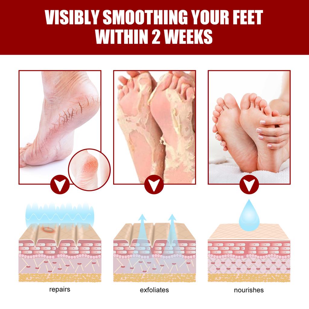 Jaysuing Fruit Acid Exfoliating Foot Mask Gently Exfoliates, Softens Calluses, Rejuvenates Skin, Moisturizes and Moisturizes Beautiful Feet
