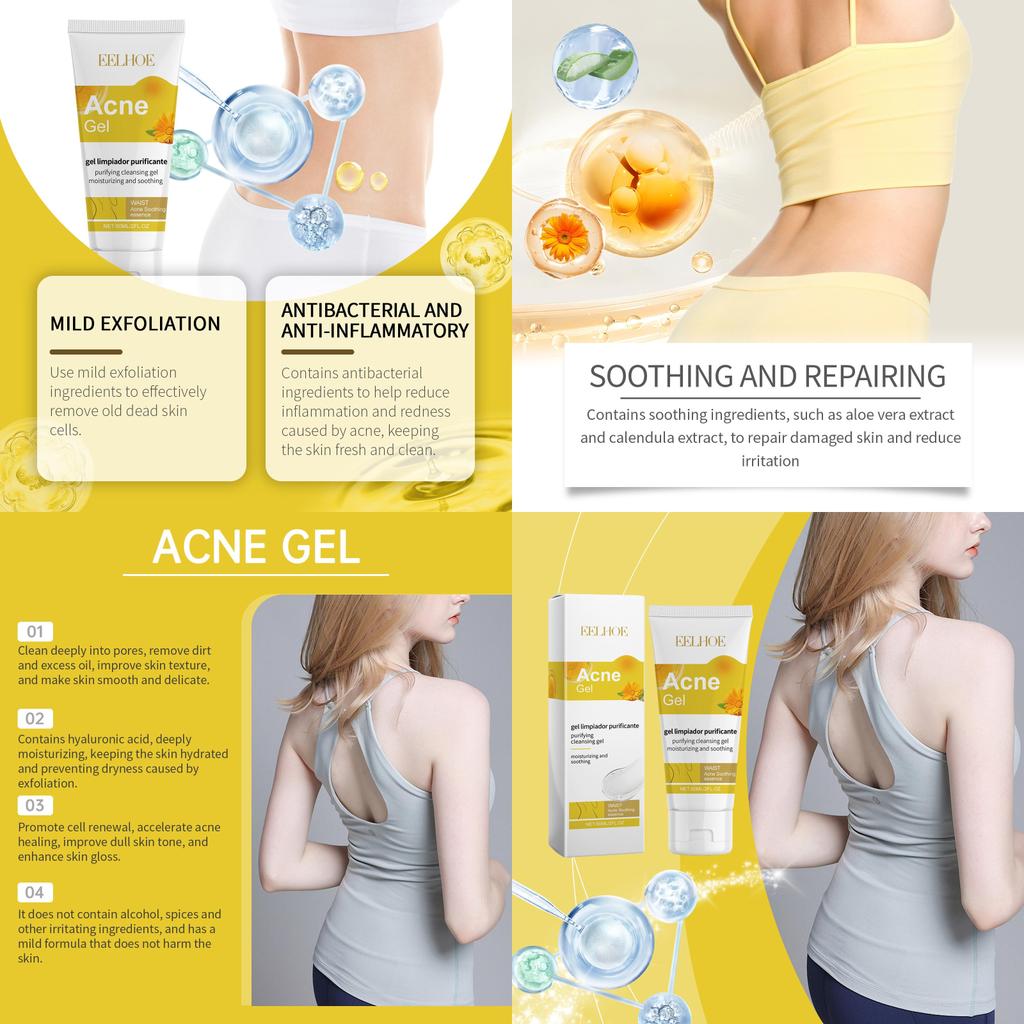 Eelhoe Soothing Acne Gel For Back Acne Gentle Skin Care Hydrating Formula 60ml