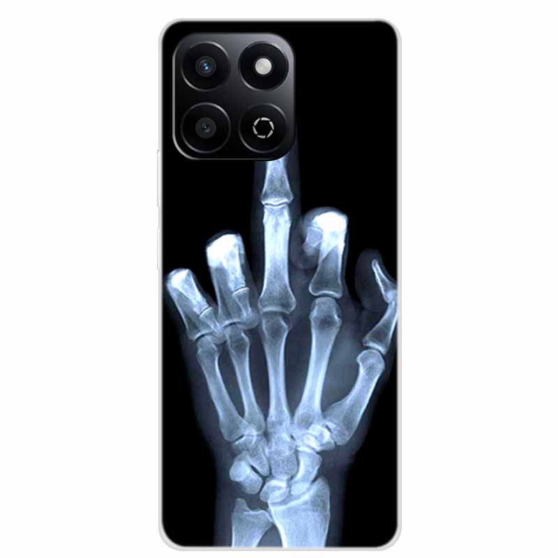 Cool Case For Honor X8C X8b X5b Plus Play 9A X6b X7c X6c Phone Case X 8 6 c b Clear Coque Transparent Silicone Soft Back Cover