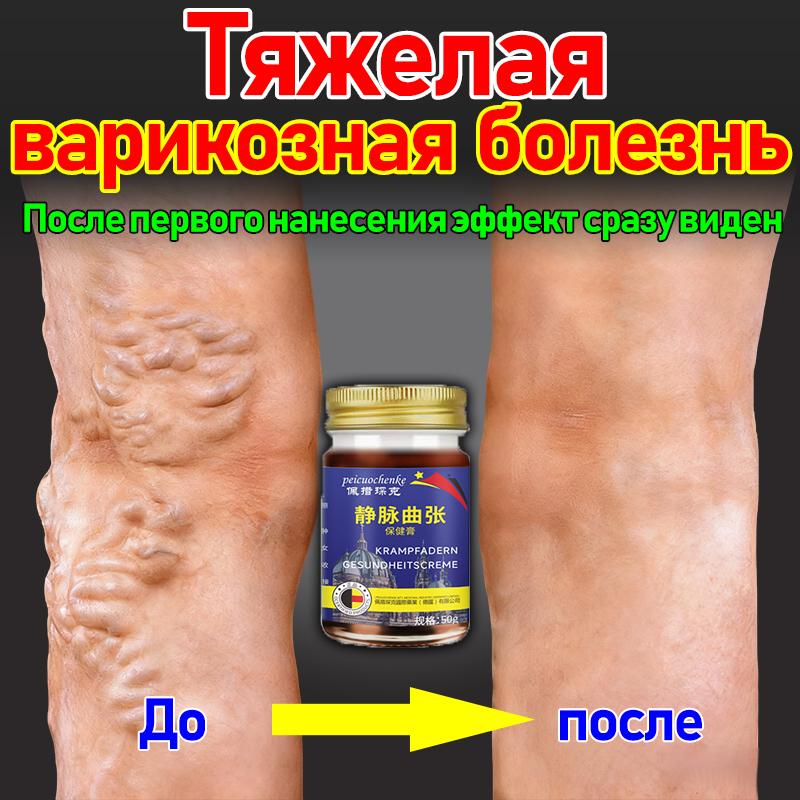 

Петрощенк, лекарство от варикоцеле, увеличения мошонки у мужчин, отека яичек, боли