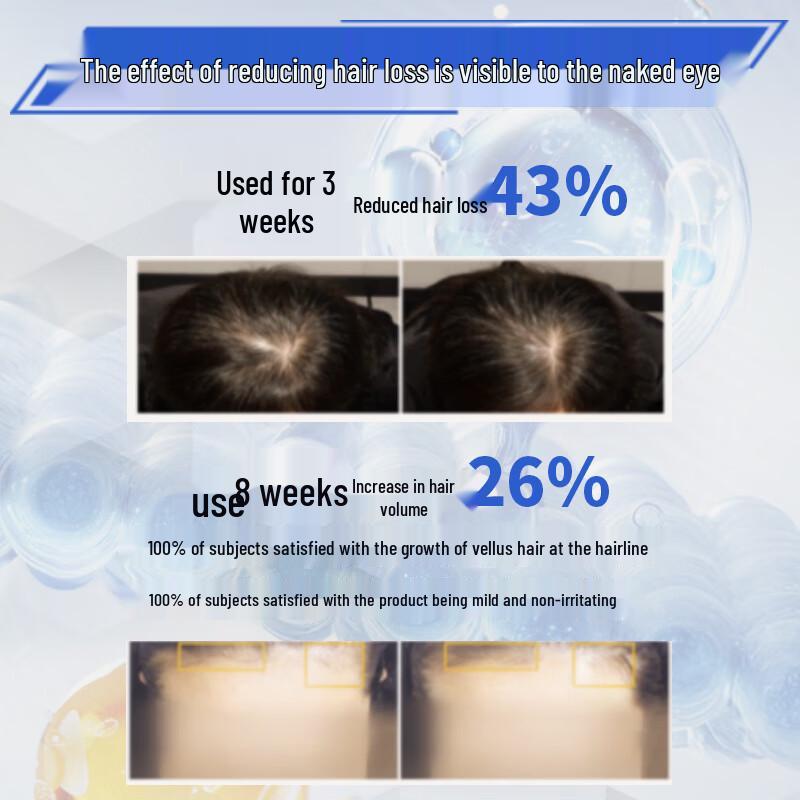 Qingsi Shijia Hair Growth & Anti-Loss Scalp Essence