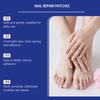 Fungal Nail Hands And Feet Soft Nail Inlaid Nail Thickening Bright Nail Furrow Gray Nail Care Patch .32pcs