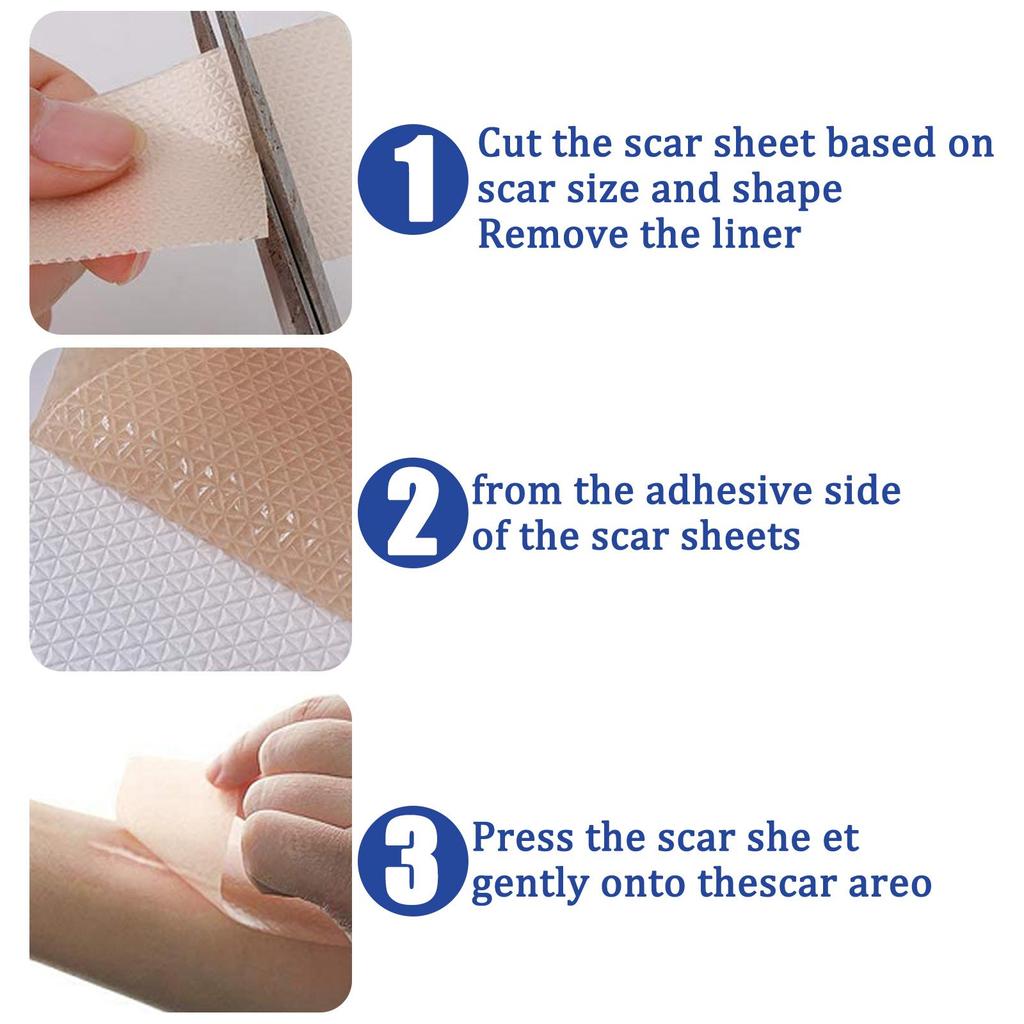 South Moon Self-Adhesive Silicone Scar Patch Repair Burn Scars Smooth Skin Wound Care Patch