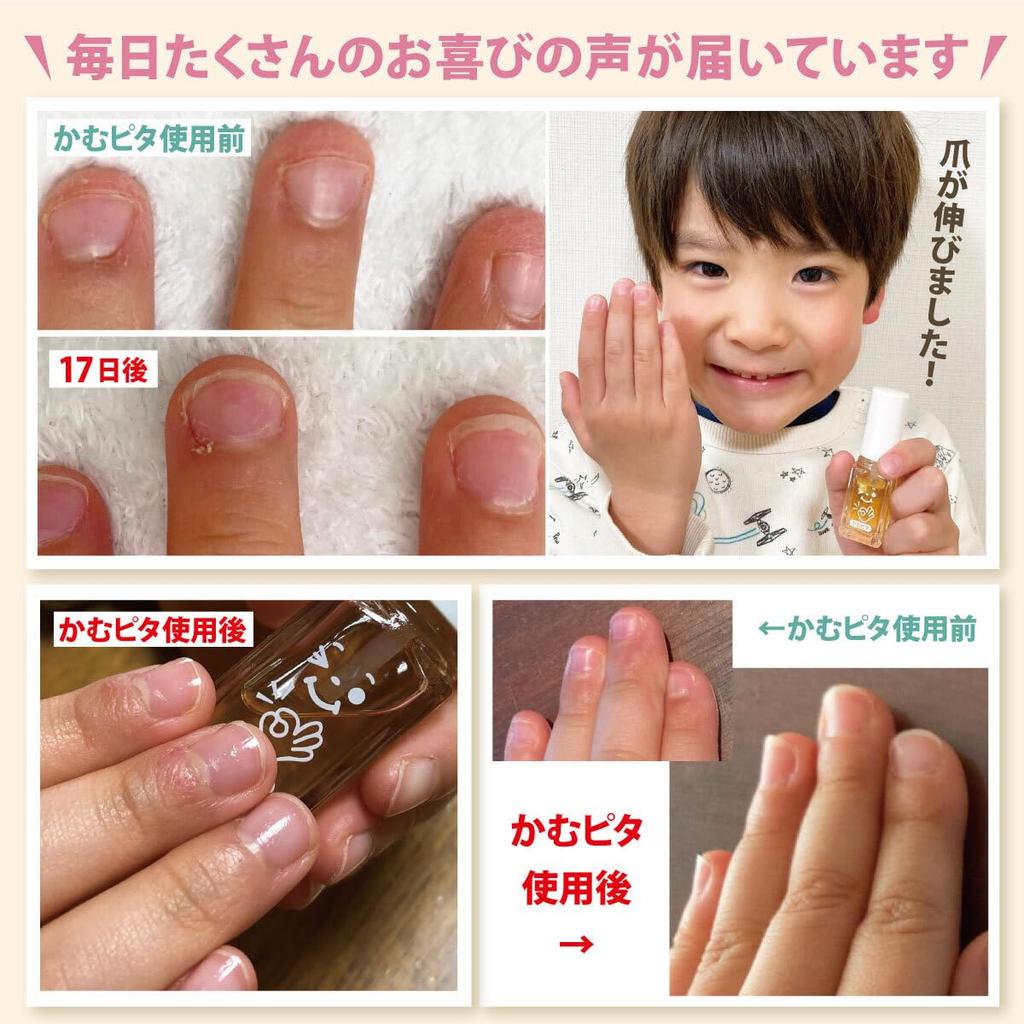 Verhindert Nagelbeißen und Daumenlutschen ist ein Nagellack, perfekt für Erwachsene, die ihre beißen, und enthält biologische Kinder. """Kamupita Plus"""