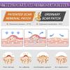 Flexible Silicone Scar Patches 4X150CM Scar Management Portable Scar Sheets for Adults Skin Repair Solution