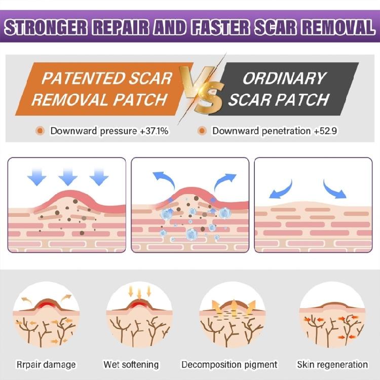 Flexible Silicone Scar Patches 4X150CM Scar Management Portable Scar Sheets for Adults Skin Repair Solution
