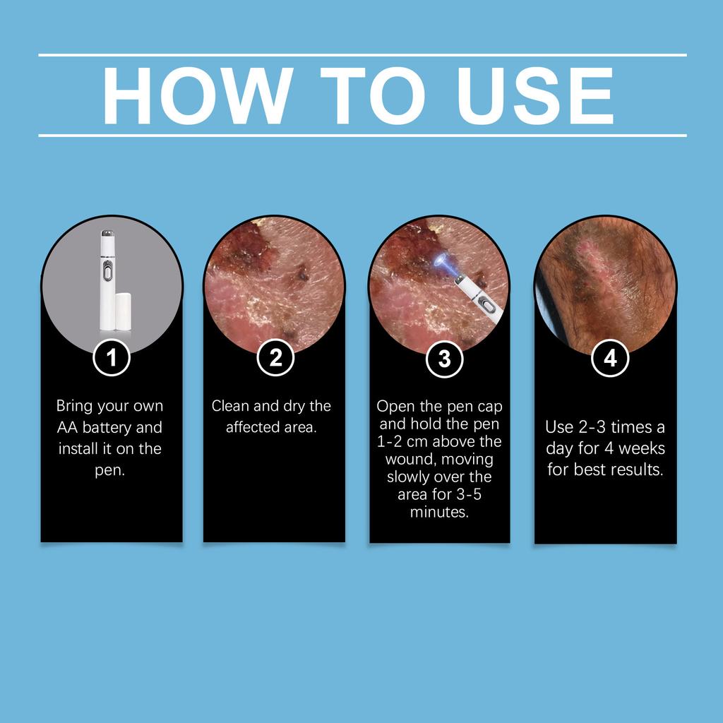 The Pen Promotes Blood Circulation And Assists In Epidermal . It Is Designed For Portable Home Use.