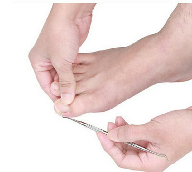 Ingrown Toenail Spoon Pick & Cleaner Tool