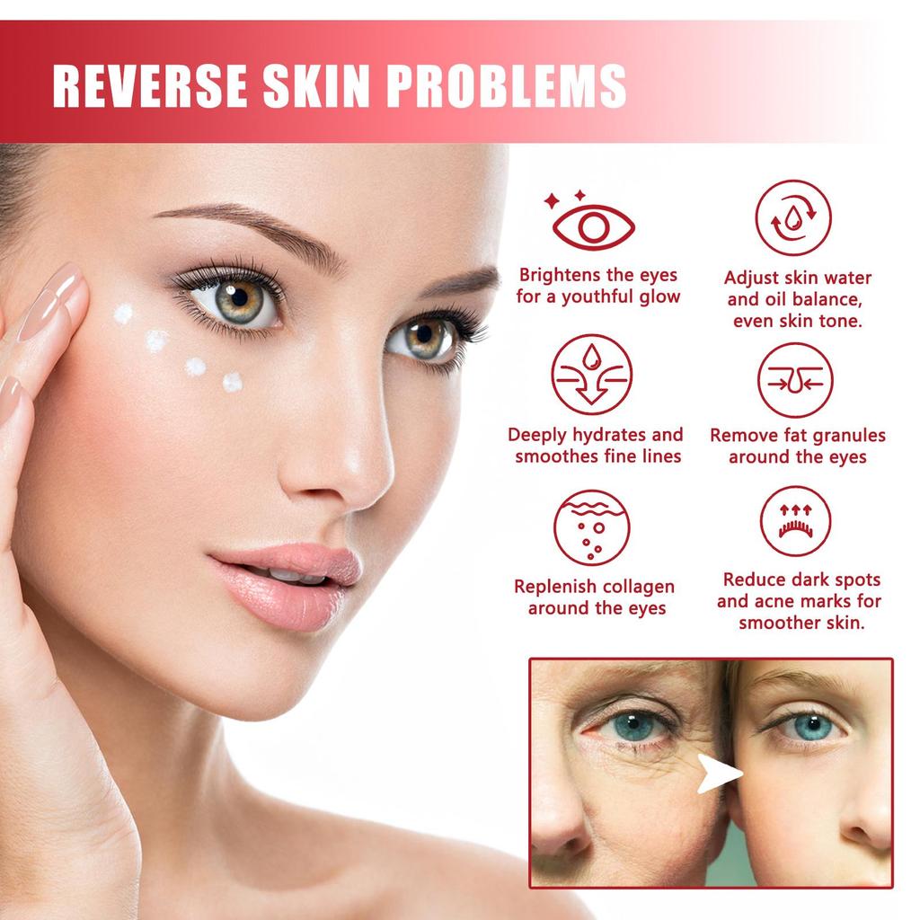 West&Month Propolis Anti-Wrinkle Eye Cream, Moisturizes Eyes, Reduces Fine Lines and Dark Spots, Firms and Brightens, Removes Milia 30g