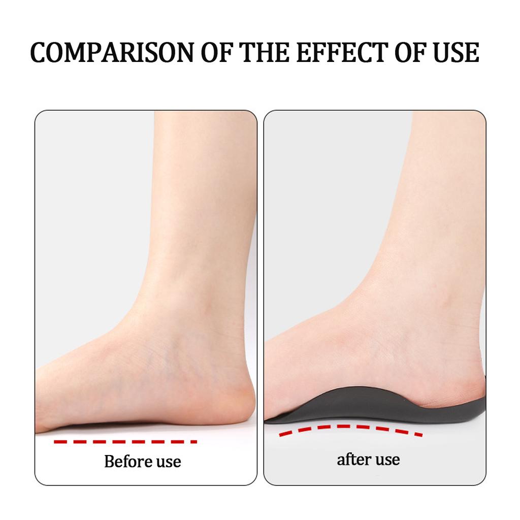 Plantar Fasciitis Relief Arch Support Inserts Flat Feet Orthotics Women Men for Foot Pain Relief, X/O Legs Correction Foot Care